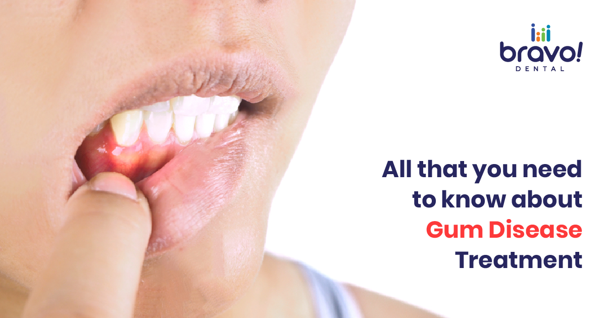 How gum disease treatment can increase your confidence