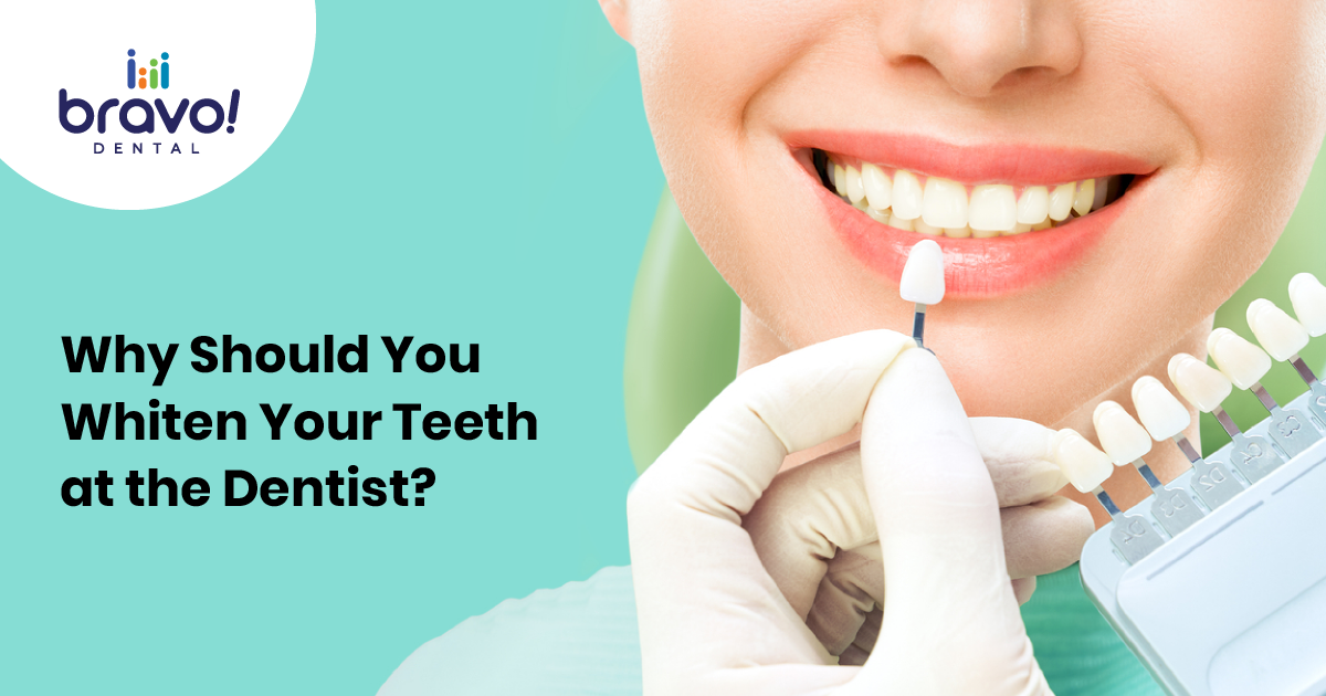 Why Should You Whiten Your Teeth at the Dentist?