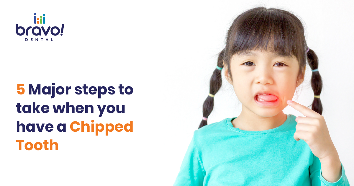 5 Steps You Have To Take When You Have A Chipped Tooth