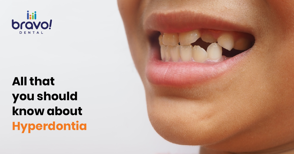 All that you should know about Hyperdontia