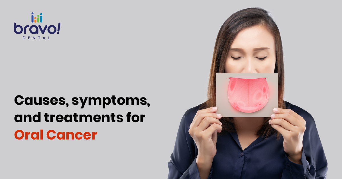 Causes, symptoms, and treatments for Oral Cancer