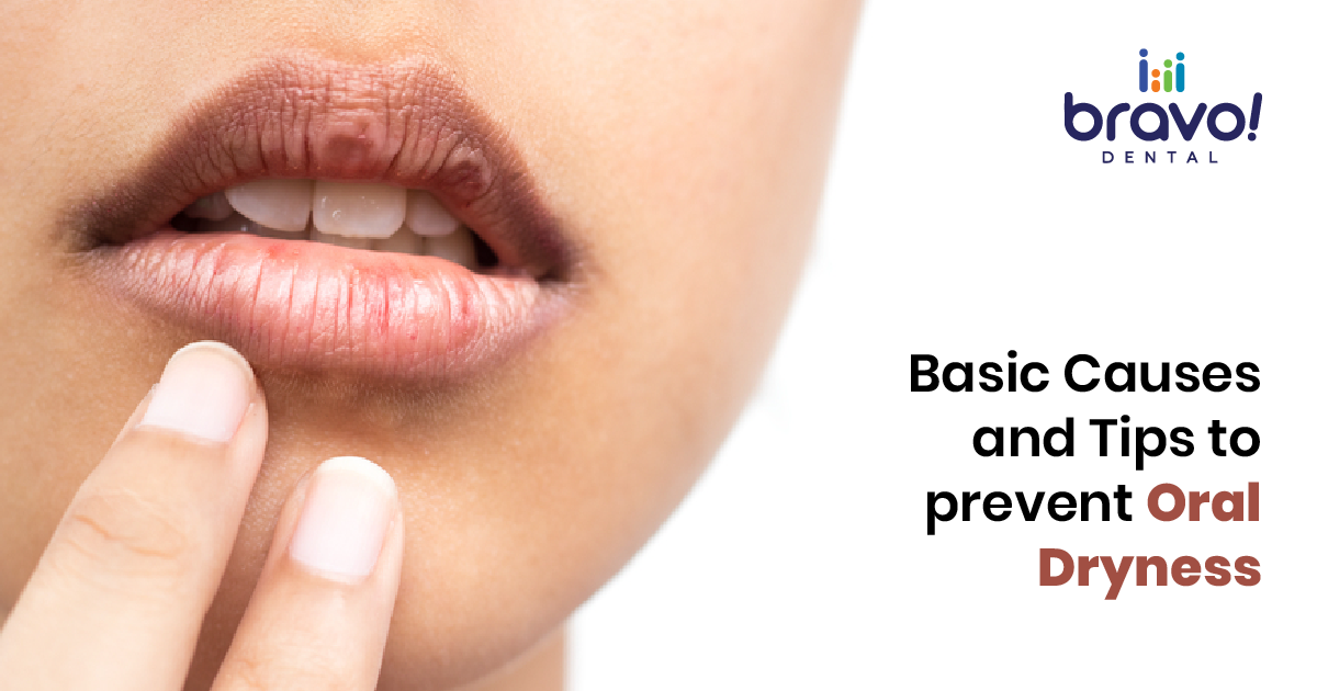 Basic Causes and Tips to prevent Oral Dryness