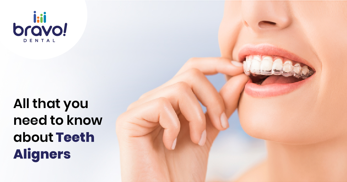 All that you need to know about Teeth Aligners