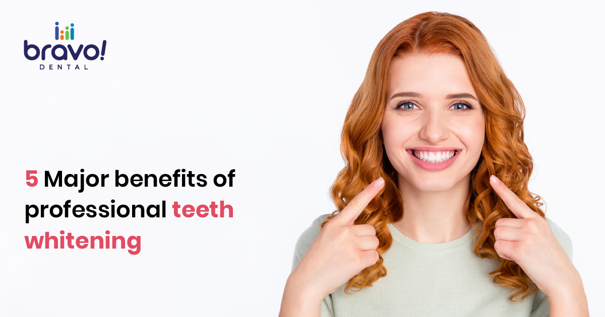 5 Major benefits of professional teeth whitening