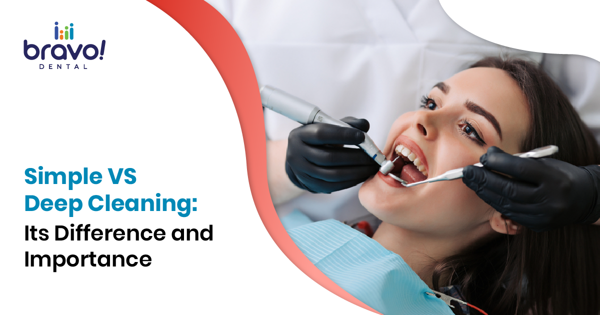 Simple VS Deep Cleaning: Its Difference and Importance