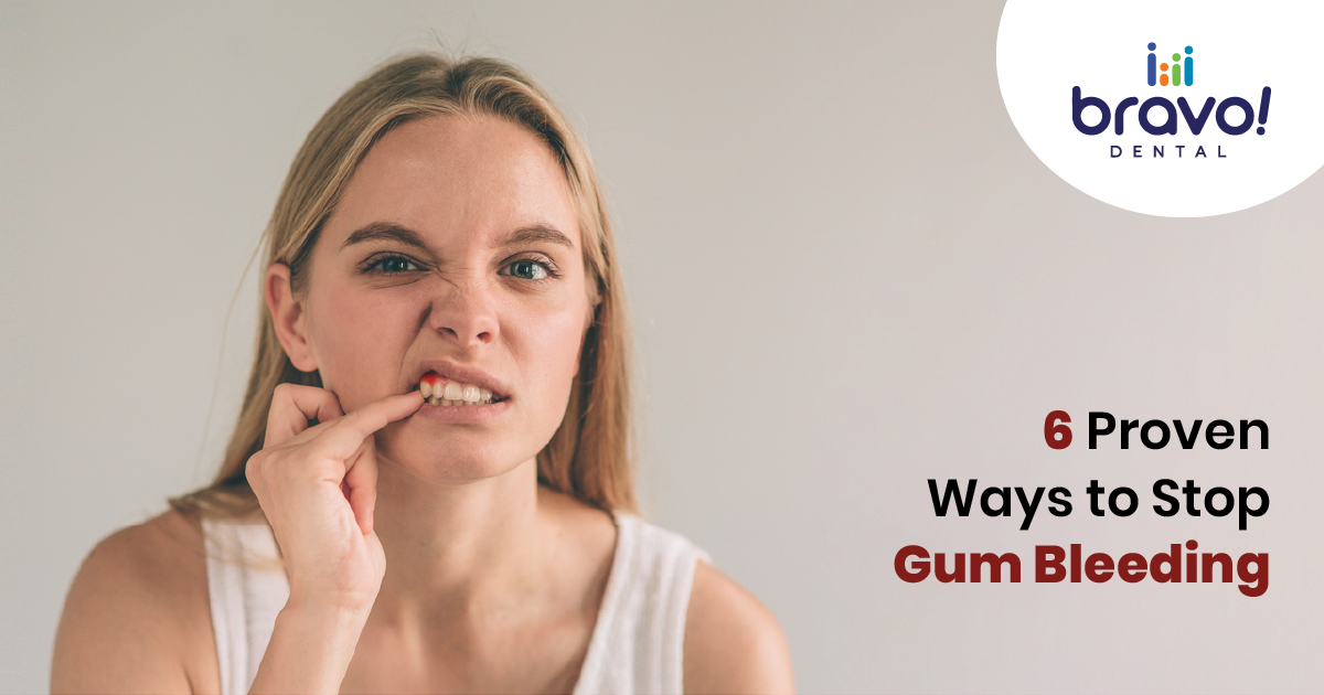6 Proven Ways to Stop Gum Bleeding