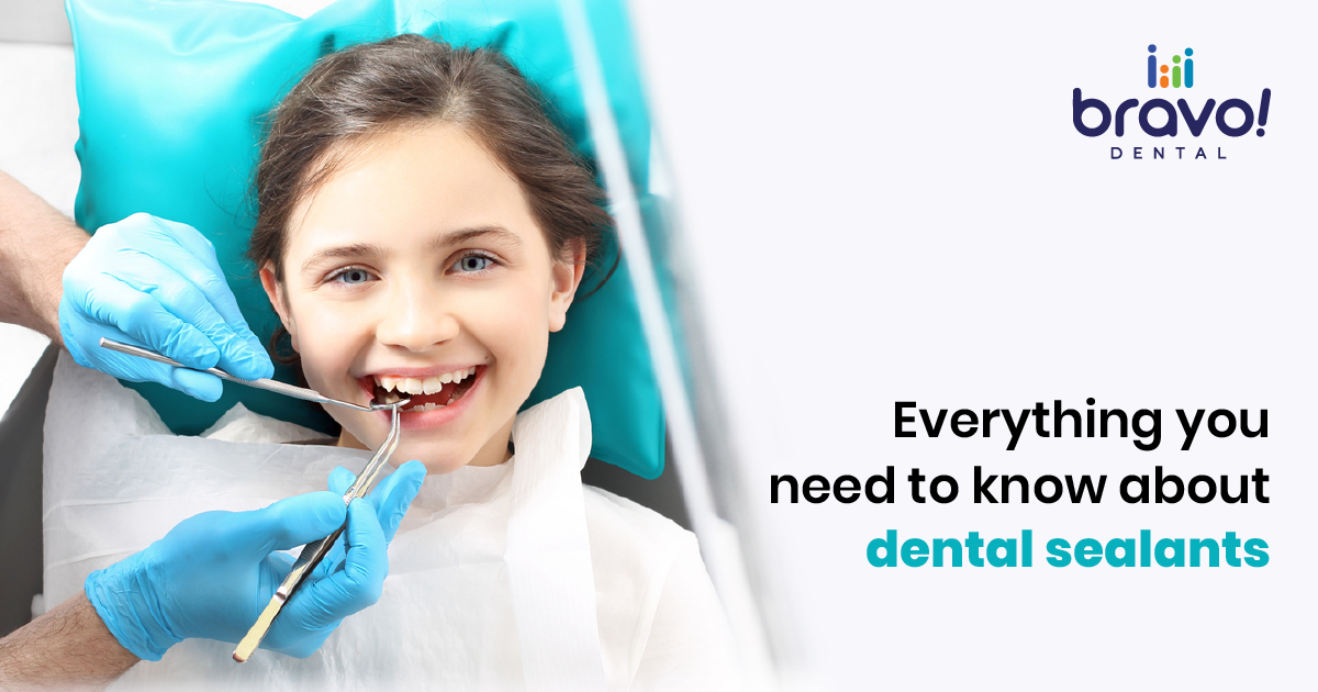 Everything you need to know about dental sealants