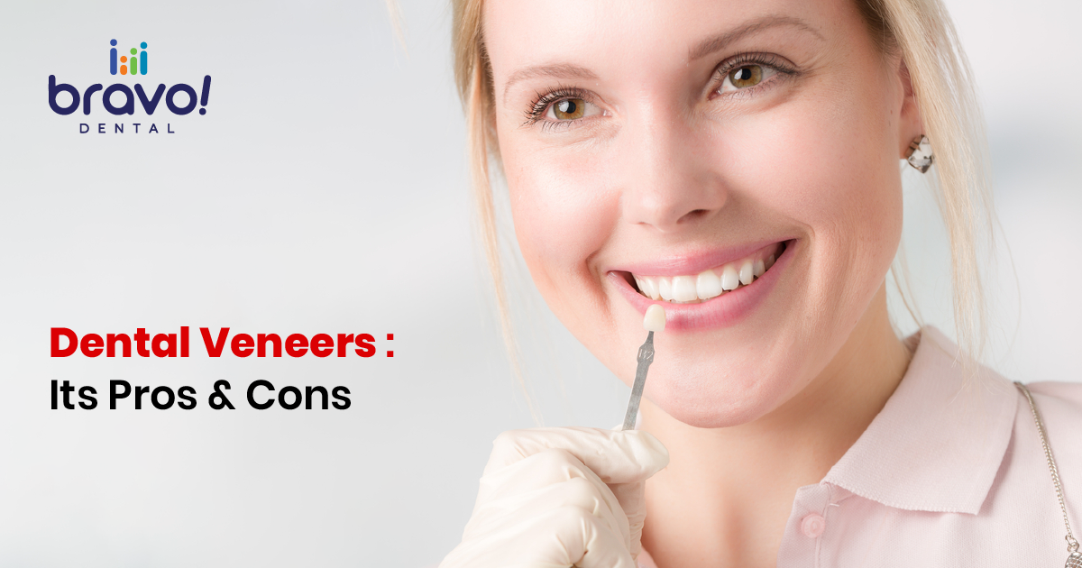 Dental Veneers: Its Pros & Cons