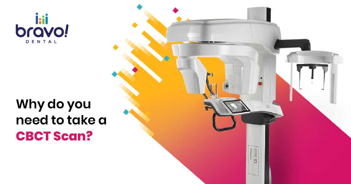 Why do you need to take a CBCT Scan?