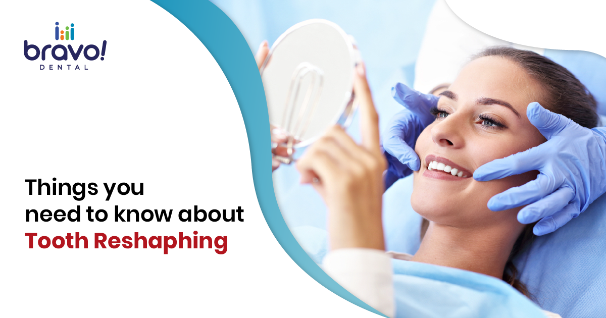 Things you need to know about Tooth Reshaping