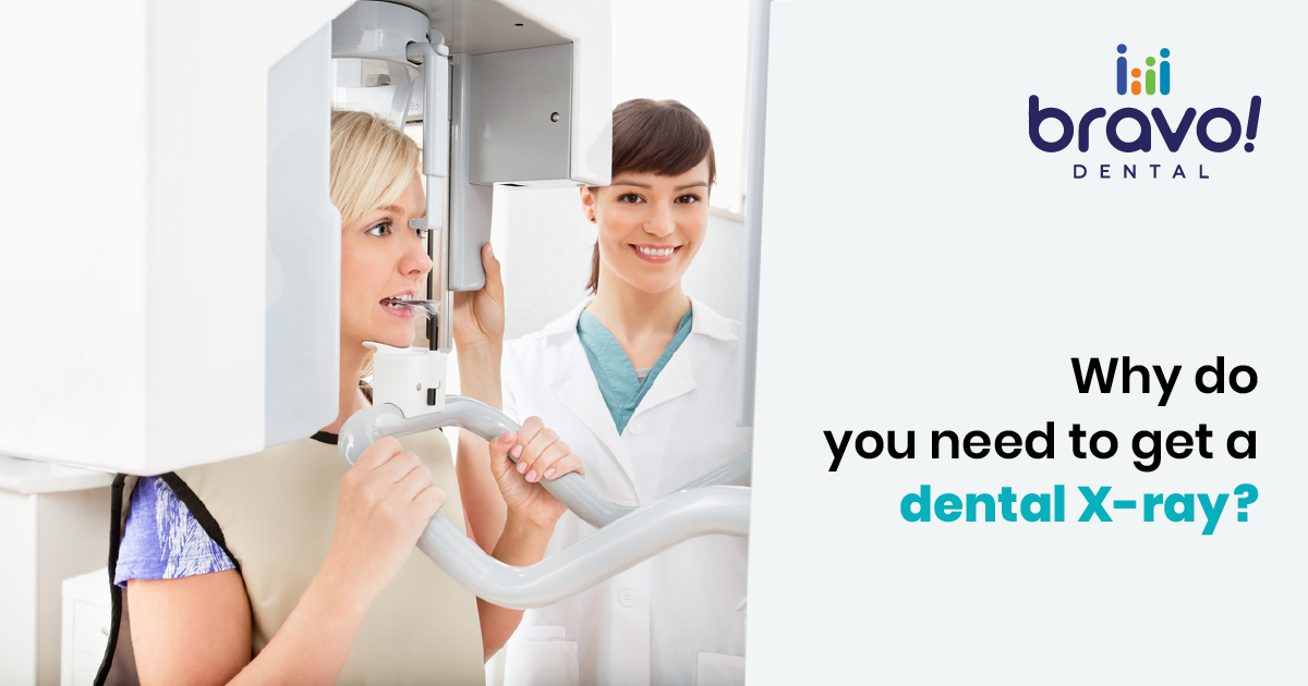 Why do you need to get a dental X-ray?