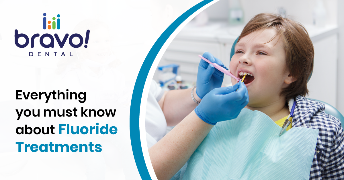 Everything you must know about fluoride treatments