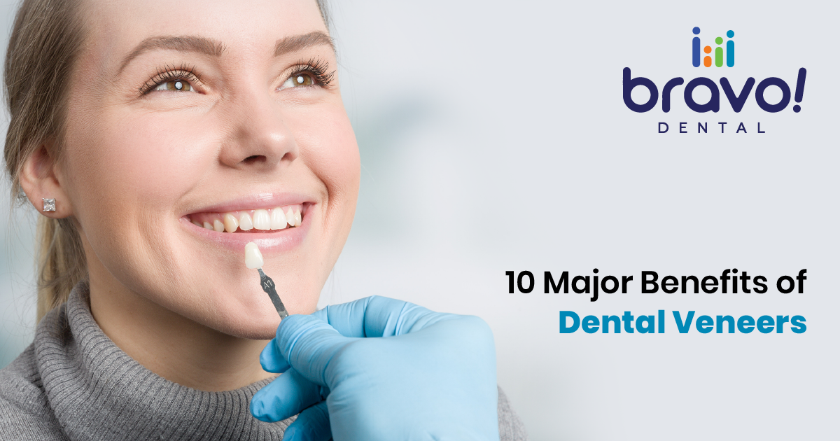 10 Major Benefits of Dental Veneers