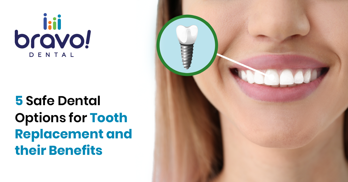 5 Safe Dental Options for Tooth Replacement and their Benefits