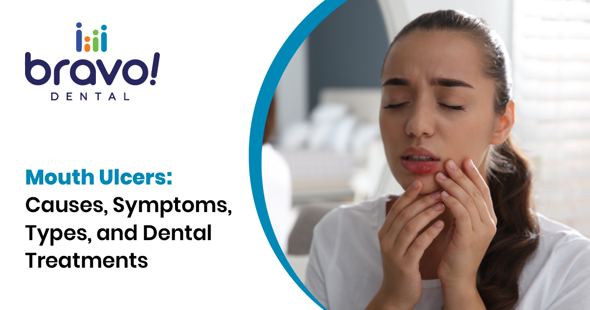Mouth Ulcers: Causes, Symptoms, Types, and Dental Treatments