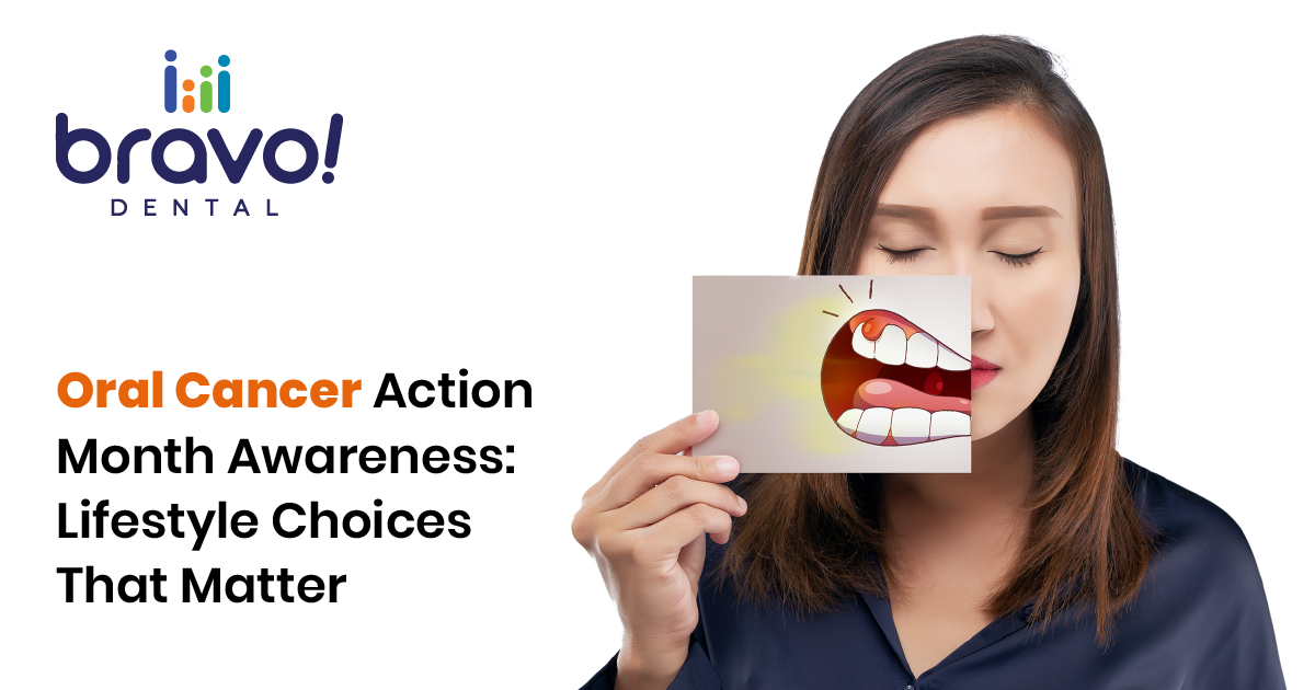 Oral Cancer Action Month Awareness: Lifestyle Choices That Matter