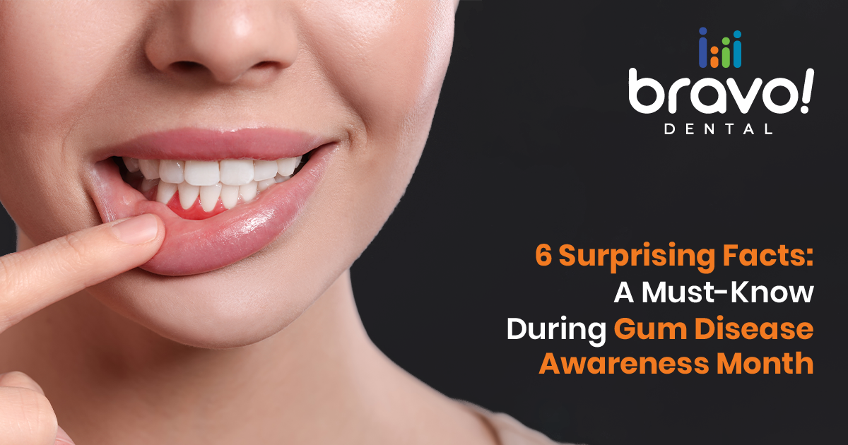 6 Surprising Facts: A Must-Know During Gum Disease Awareness Month