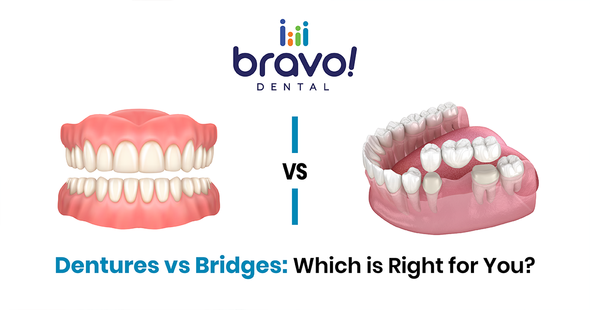 Dentures vs. Bridges: Which is Right for You?