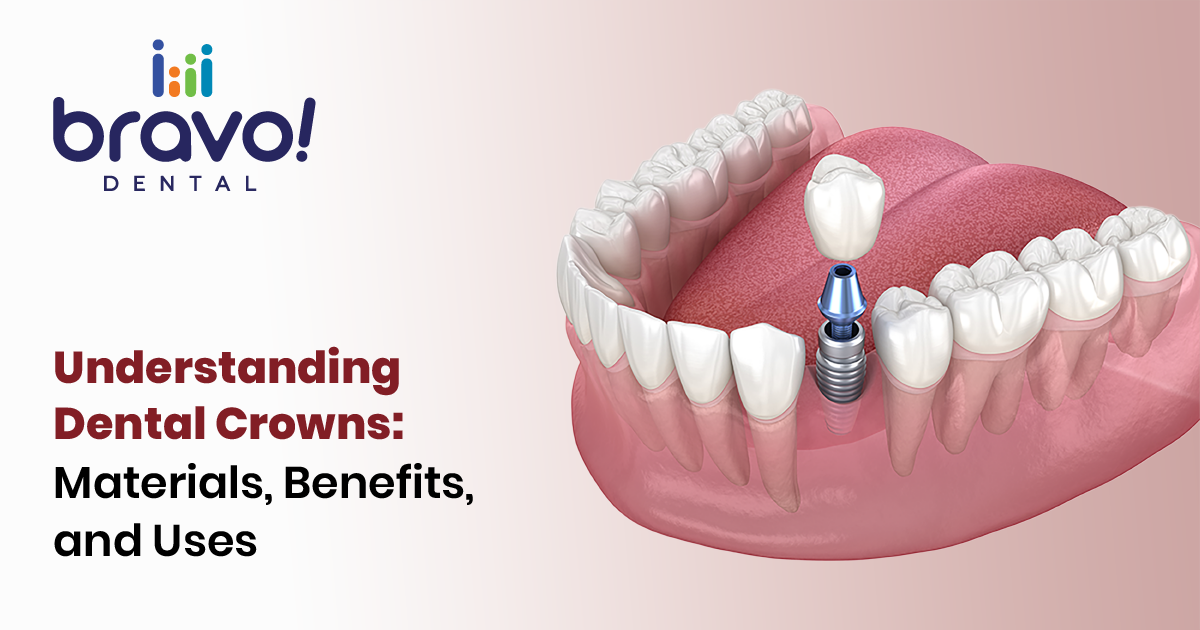Understanding Dental Crowns: Materials, Benefits, and Uses