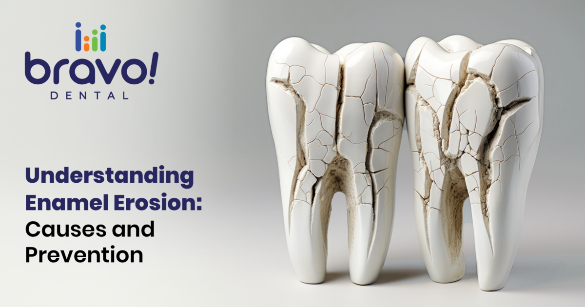 Understanding Enamel Erosion: Causes and Prevention