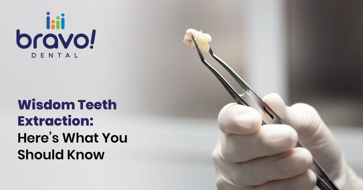 Wisdom Teeth Extraction: Here’s What You Should Know